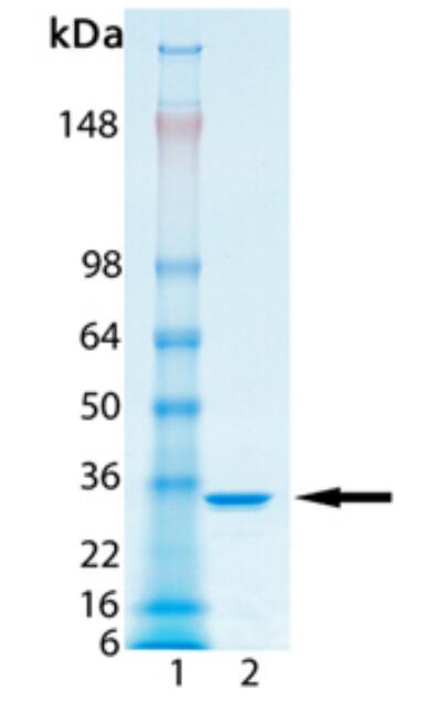 Lane 1: MW marker<br />Lane 2: 1.0 μg of purified Tetra-ubiquitin (Ub4)